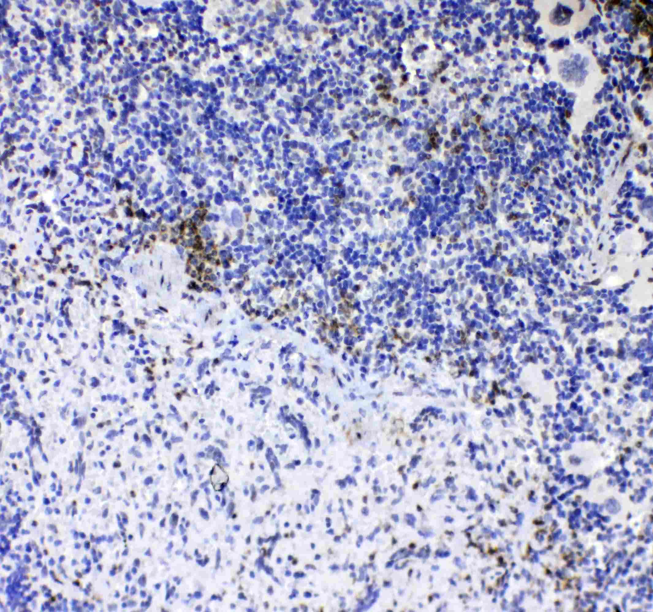 CD8A / CD8 Alpha Antibody
