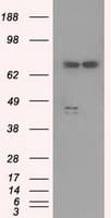 Monoclonal Mouse anti-Human PPP5C Antibody (clone OTI4E1, IHC, WB)