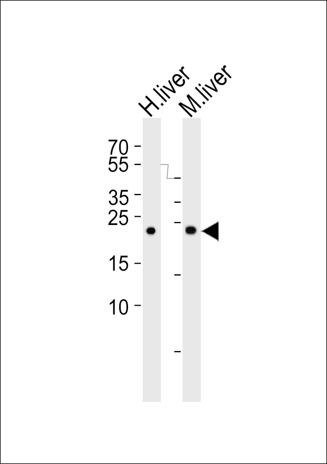 GHBP / BLVRB Antibody (aa161-175)
