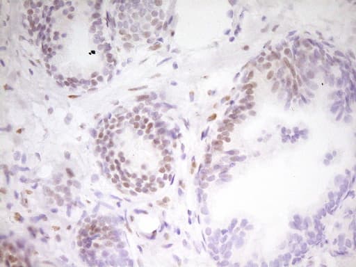 MEF2D Antibody (aa1-282, clone OTI1E11, Carrier-free)