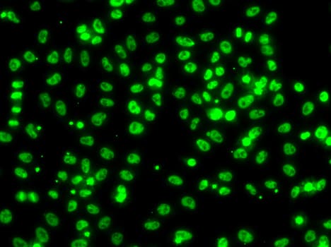 CSRNP1 / AXUD1 Antibody