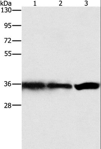 GNB1 Antibody