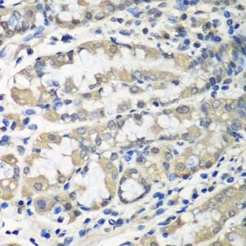 Polyclonal Rabbit anti-Human CCT6A Antibody (IHC, WB)