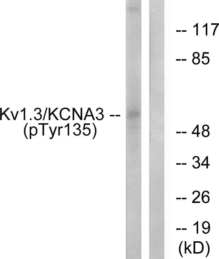 KCNA3 / Kv1.3 Antibody (phospho-Tyr135)