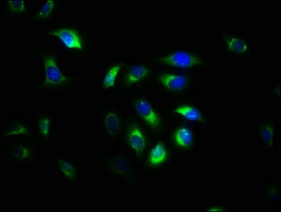 CAPNS1 / CAPN4 Antibody (aa1-268)