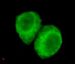 JMJD6 / PSR Antibody (N-Terminus)