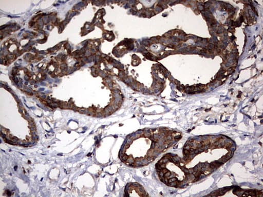 Monoclonal Mouse anti-Human KRT7 / CK7 / Cytokeratin 7 Antibody (clone OTI3B7, IHC, WB)