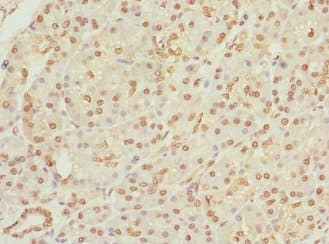 Polyclonal Rabbit anti-Human APIP Antibody (IHC, WB)