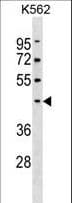 PELI1 / Pellino 1 Antibody (aa177-204)