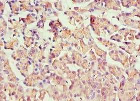 HOXB7 Antibody (aa1-120)
