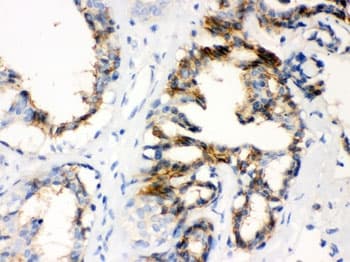 Polyclonal Rabbit anti-Human CTGF Antibody (IHC, WB)