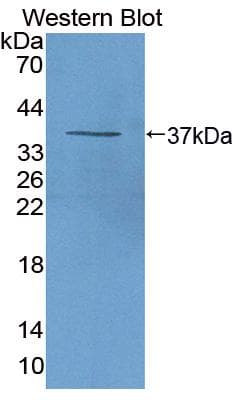 CXCL7 / PPBP Antibody (aa46-107, Cy3)