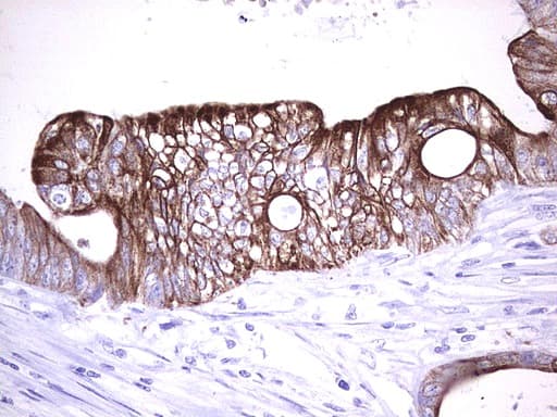 Monoclonal Mouse anti-Human KRT20 / CK20 / Cytokeratin 20 Antibody (clone UMAB167, IHC, WB)