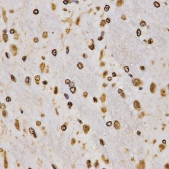 Histone H3 Antibody (Trimethyl-Lys27)