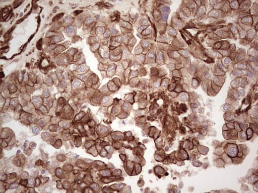 LGALS9 / Galectin 9 Antibody (clone OTI1D12)