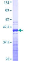 Human TNNT3 Protein (Recombinant GST, N-terminus)