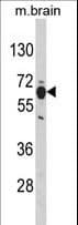PHGDH Antibody (aa140-168)