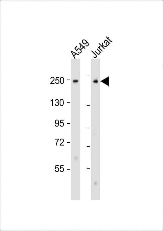COL11A1 / Collagen XI Alpha 1 Antibody (aa41-75)