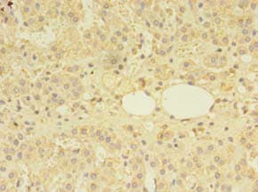 MS / MTR Antibody
