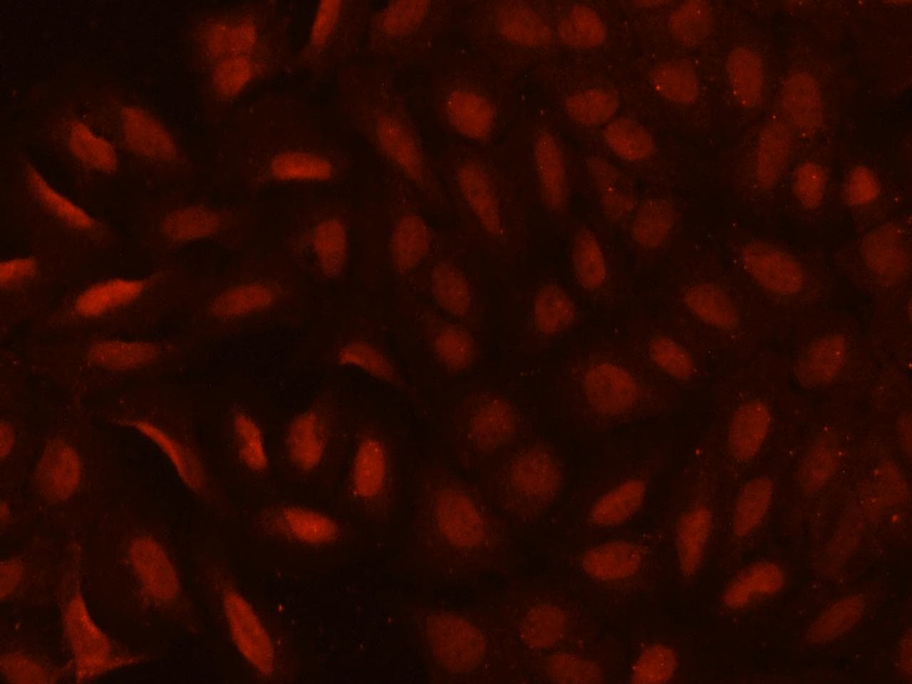 Polyclonal Rabbit anti-Human CDYL Antibody (IHC, IF, WB)