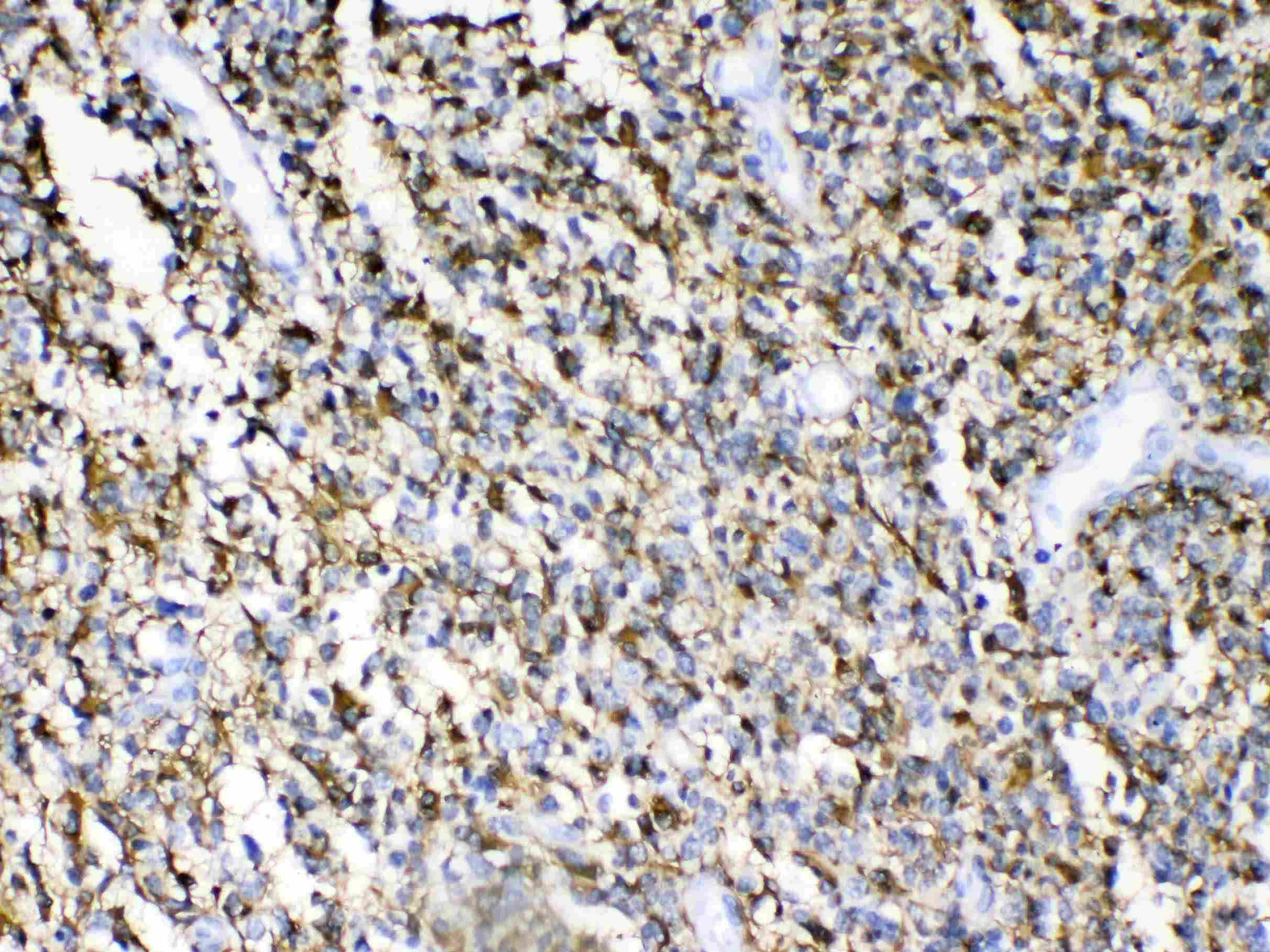 GFAP Antibody