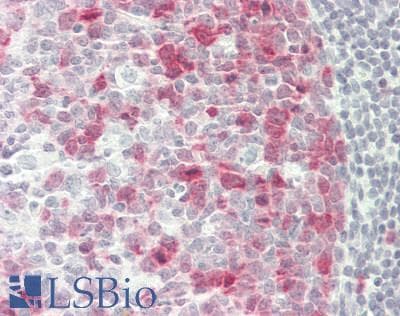 IHC-plus™ Monoclonal Mouse anti-Human UBCH10 / UBE2C Antibody (clone 9D3, IHC, IF, WB)