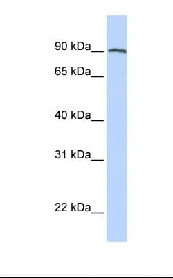 FOLH1 / PSMA Antibody (C-Terminus, FITC)