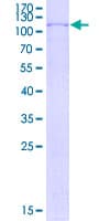 Human ZNF510 Protein (Recombinant GST)