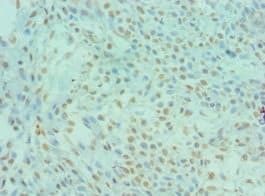 DYRK2 Antibody (aa502-601)