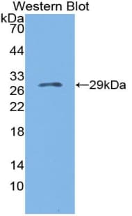 GRN / Granulin Antibody (aa31-269)