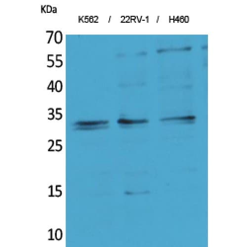 SYCP3 / SCP3 Antibody (Internal)