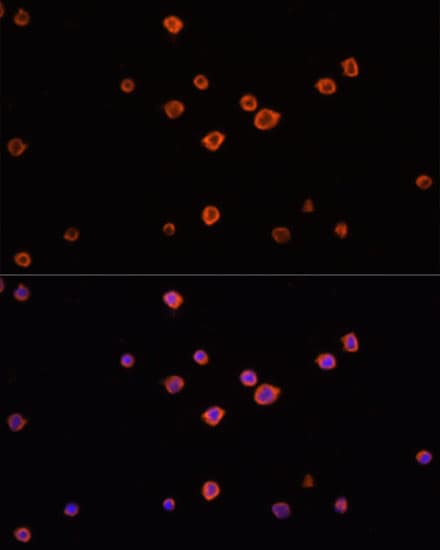 CD45 / LCA Antibody