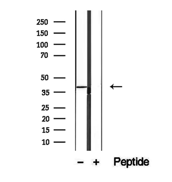 URAT1 / SLC22A12 Antibody