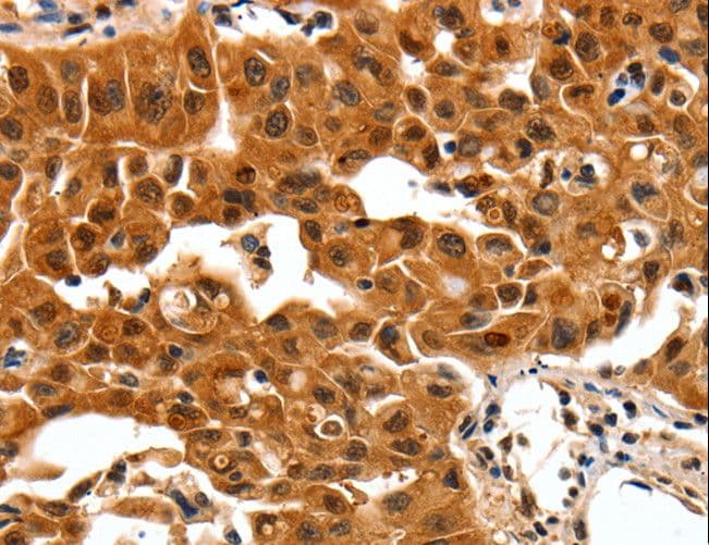 YWHAB / 14-3-3 Beta Antibody