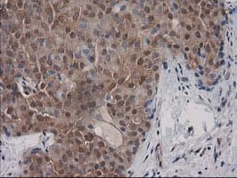 DSTN / Destrin Antibody (clone OTI1D5)