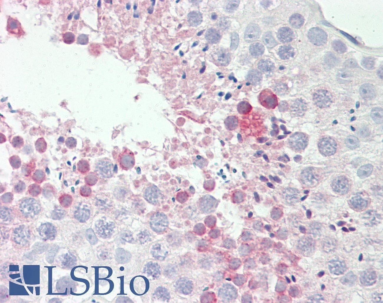 IHC-plus™ Polyclonal Rabbit anti-Human PABPC3 Antibody (aa107-323, IHC, WB)