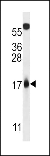 p14ARF / CDKN2A Antibody (aa72-101)