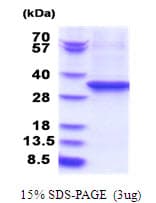 Human EEF2 / Elongation Factor 2 Protein (Recombinant His)