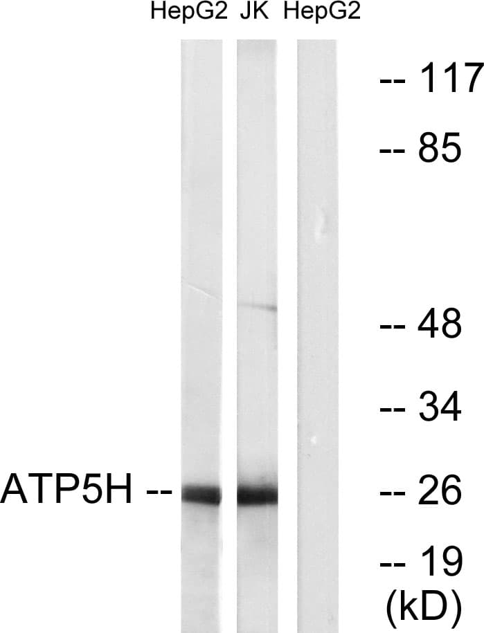 IHC-plus™ ATP5H Antibody (aa111-160)