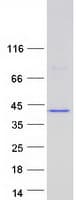 Human ANKRD16 Protein (Recombinant Myc-DDK (Flag))