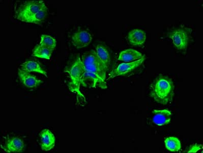SLC25A14 / UCP5 Antibody