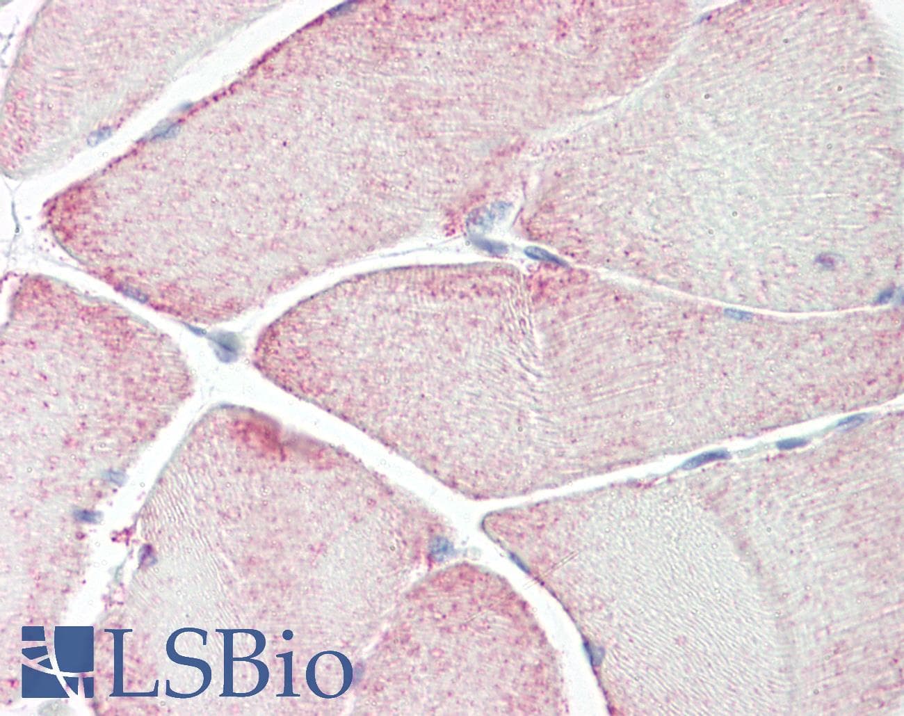 IHC-plus™ RPL3L Antibody (aa211-260)
