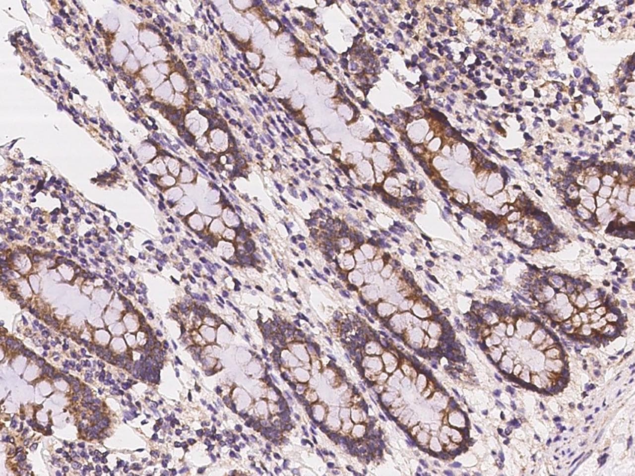 VISA / MAVS Antibody