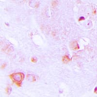 Polyclonal Rabbit anti-Human ALDOC / Aldolase C Antibody (Internal, IHC, WB)