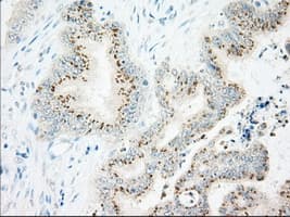 IFT57 / HIPPI Antibody (clone OTI5B6)