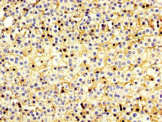 Polyclonal Rabbit anti-Human USP20 / VDU2 Antibody (IHC)