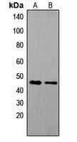 TACR1 / NK1R Antibody (Internal)