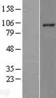Human RHBDF2 Protein (Over-Expression Lysate Myc-DDK (Flag))