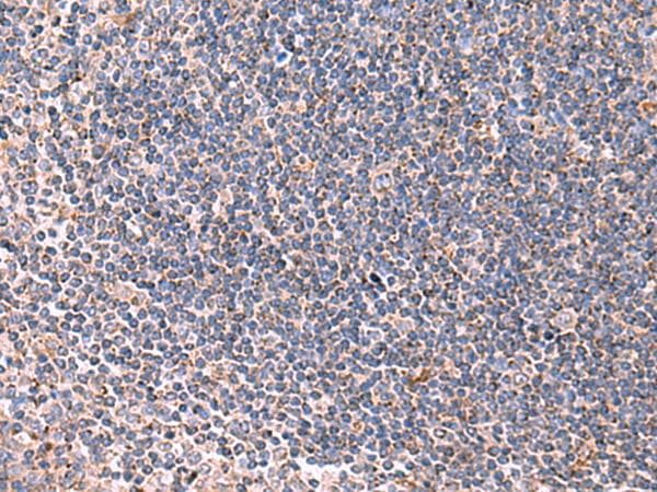 Polyclonal Rabbit anti-Human LIPA / Lysosomal Acid Lipase Antibody (IHC)