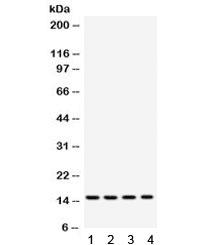 FABP3 / H-FABP Antibody (aa119-133)